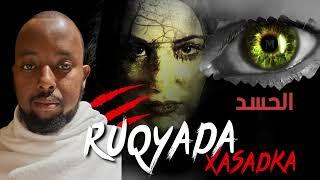 Ruqyah xasadka habaar xoogan