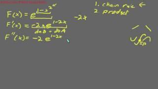 Inflection Point Problem - Calculus