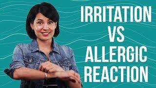 Beauty Edu: Irritation vs Allergic Reaction