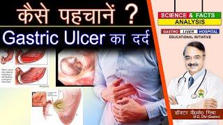 कैसे पहचानें गैस्ट्रिक अलसर का दर्द  || GASTRIC ULCER PAIN