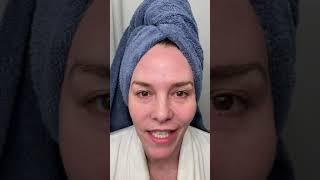 Medical Esthetician Victoria Lewis on Microneedling