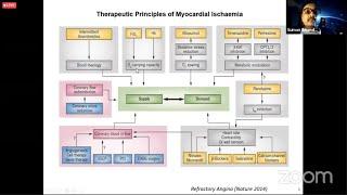Refractory Angina by Dr. Suman Bhandari sir