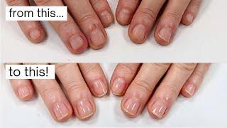 How did she stop biting & picking her nails? [week by week progress]