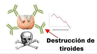 Principales causas de enfermedad de la tiroides