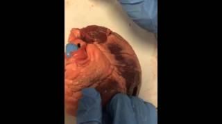 Leanne Findley Heart Dissection