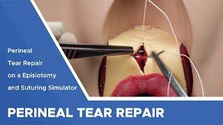 1st and 2nd Degree Perineal Tear Repair on a Episiotomy and Suturing Simulator