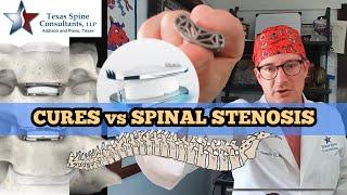 Can spine stenosis be 'cured'?!