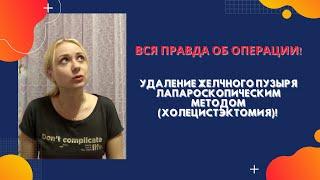 Удаление желчного пузыря лапароскопическим методом (холецистэктомия)! Вся правда об операции!