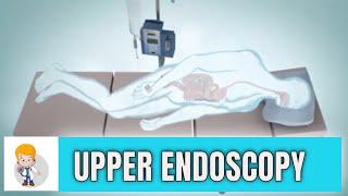 Upper GI endoscopy: Esophagogastroduodenoscopy (Animation 3D)