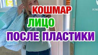 СРОЧНО МУЖУ ВТОРАЯ РАБОТА | ПОДТЯЖКА ЛИЦА | НИЖНЯЯ БЛЕФАРОПЛАСТИКА