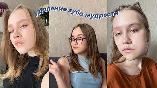 удаление зуба мудрости // мой опыт