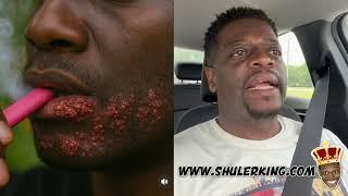 Shuler King - Can’t Put Ya Mouth On Everything