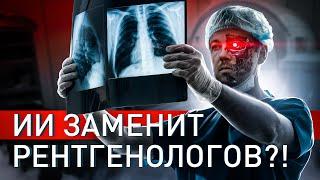 ️ ИИ, КОТОРЫЙ ЛИШИТ ВРАЧЕЙ РАБОТЫ: ПРОРЫВ ИЛИ УГРОЗА?!