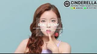 My Plastic Surgery Experience | Cinderella Clinic Korea Plastic Surgery | Yoojin