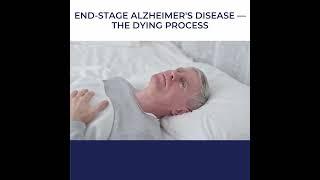 Uncovering the Reality of End-Stage Alzheimer's: How the Dying Process Unfolds ‍