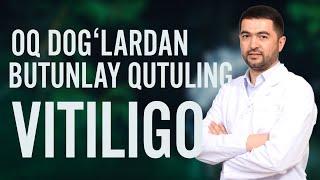 Oq dog'larning kelib chiqishi va uni davolash usullari.