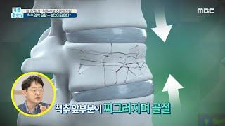 [기분 좋은 날] 척추 압박 골절, 수술만이 답이다?, MBC 210604 방송