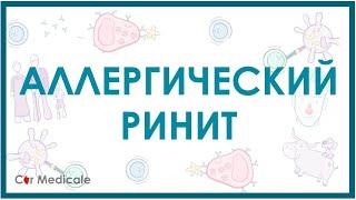 Аллергический ринит - причины, симптомы, лечение