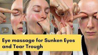 Eye massage for Sunken Eyes and Tear Trough