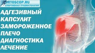 АДГЕЗИВНЫЙ КАПСУЛИТ.ЗАМОРОЖЕННОЕ ПЛЕЧО.FROZEN SHOULDER