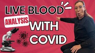 Live Blood Analysis and Covid 