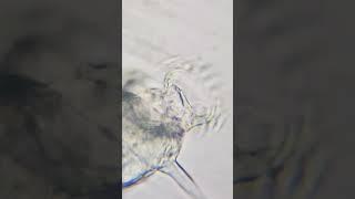 The corona of the Rotifer! #rotifer #rotifera #microorganism #microbiology