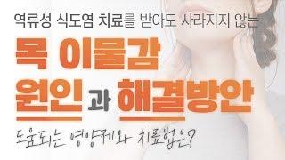 역류성 식도염을 치료해도 사라지지 않는 목 이물감 그 해결방안은?