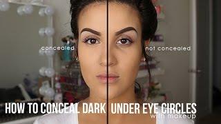 How to Conceal Dark Under Eyes With Makeup