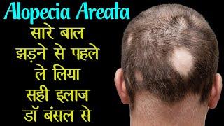 Hair Regrowth Treatment by Dr. Bansal | Revive Your Hair Naturally!