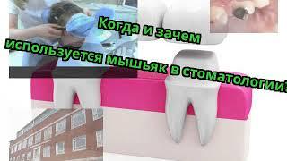 Когда и зачем используется мышьяк в стоматологии?