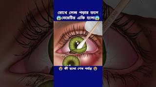 চোখে লেন্স ঢুকে মেয়েটির একি হলো #cartoon #3danimation