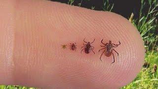 Doctor explains what you should know about ticks