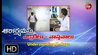 Aarogyamastu | Understanding your x-rays | 21st July 2017 | ఆరోగ్యమస్తు