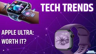 The Smart Watch That Does It All