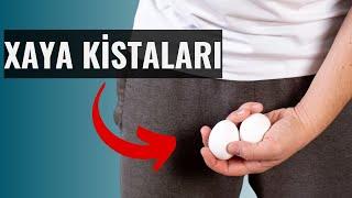 XAYA KİSTALARI SONSUZLUQ Xəstəliyinə Səbəb olur! | Azər Mirzəyev