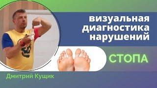 Диагностика стопы. Функциональная кинезиология Дмитрия Кущика