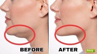 Double Chin? Try These Natural Home Remedies!