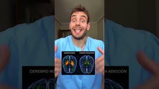 Effects of alcohol on your brain  #trivia #didyouknow