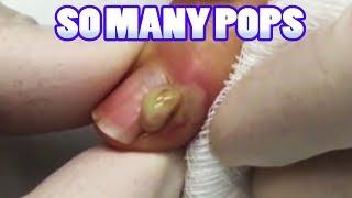 Pops, Poppers & YouTube's Best Doctors! John Gilmore M.D.