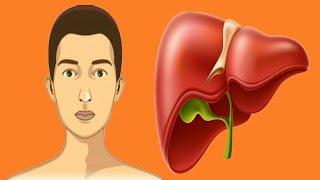 High Bilirubin levels: Main Causes