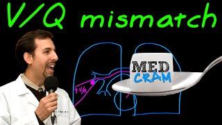 Ventilation Perfusion (VQ) Mismatch Explained Clearly