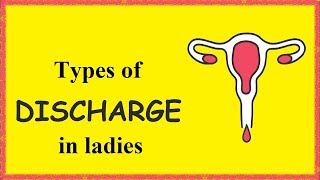 Types of discharge in ladies (Urdu/Hindi)