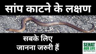 सांप काटने के लक्षण, सबके लिए जानना जरुरी हैं Symptoms of Snake Bite