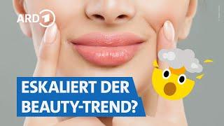 Hyaluron spritzen „to go“ – darum kann das gefährlich werden  | WDR Markt