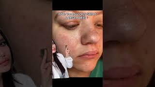 Do you have OILY SKIN & LARGE PORES?! #skincare #skincareroutine