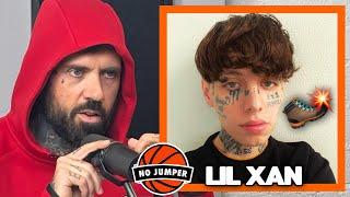 Lil Xan is Facing Backlash For Kicking a Fan in the Face