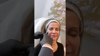 Rejuvenate Your Skin with DAXXIFY at AdmireMD Skin Clinic in North Scottsdale! 