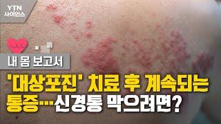 [내 몸 보고서] '대상포진' 치료 후 계속되는 통증…신경통 막으려면? / YTN 사이언스