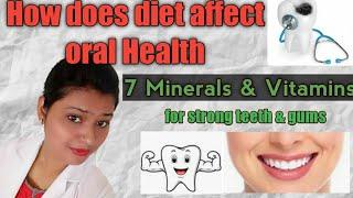 Healthy foods for teeth & gums,  Dr Kanchan,दातों के लिए  healthy food.