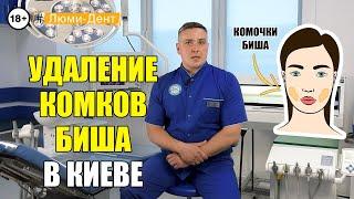 Удаление комков Биша: Как убрать щеки (Видео) Люми-Дент Киев.